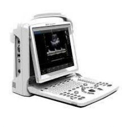 CHISON ECO3 Expert Ultrasound Machine with convex transducer